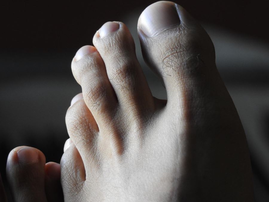 Cuidados de los pies